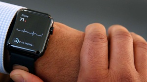 Ura Apple Watch je uradno medicinski pripomoček